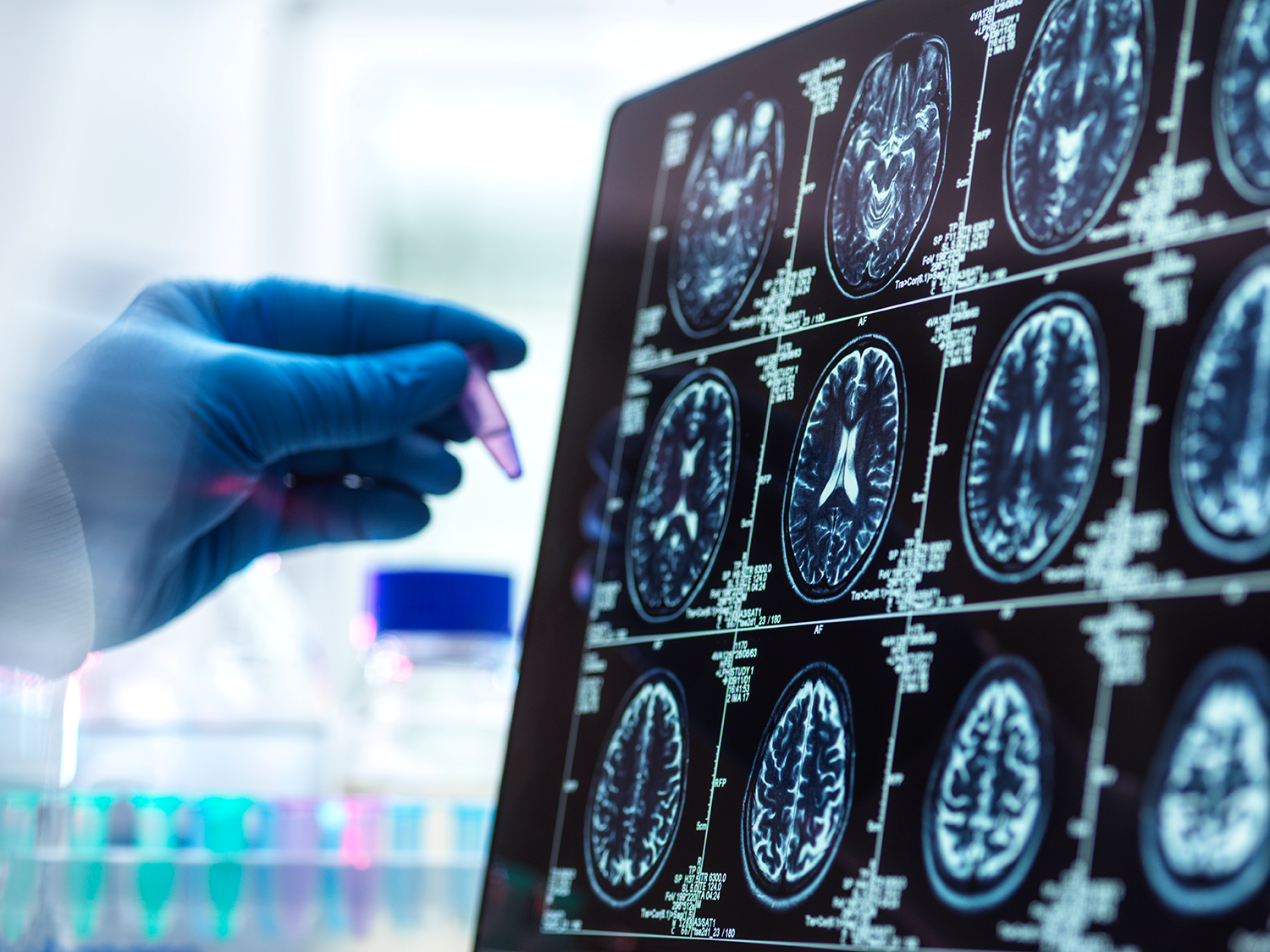 Life Science_Alzheimers_imsbrnd00332_webb.png